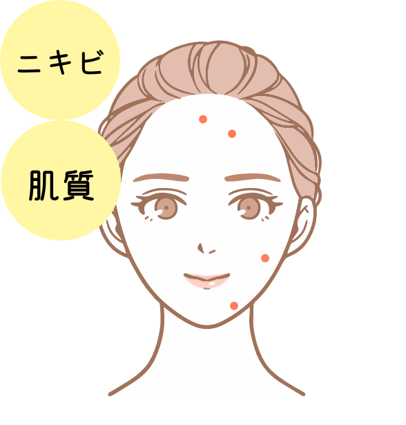 ニキビ